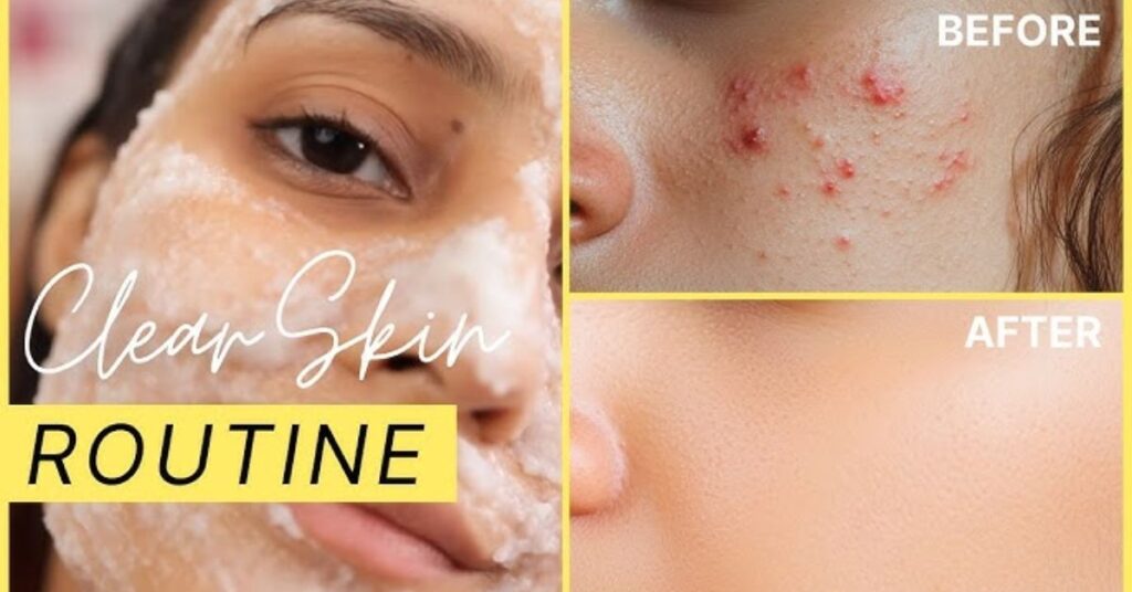 daily skin care with acne routine steps cleanser toner moisturizer