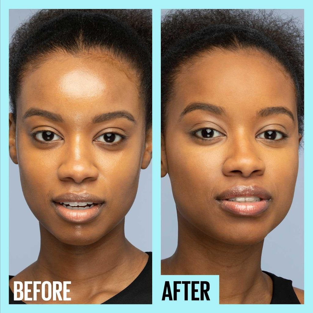 acne prone skin before and after using primer