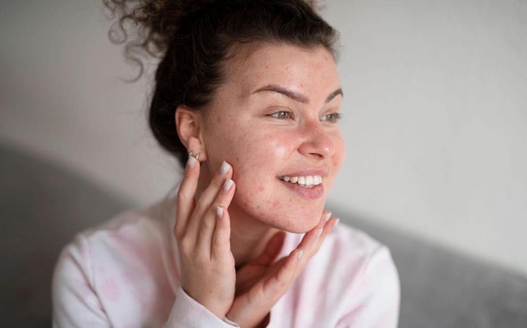 applying primer on acne prone skin step by step