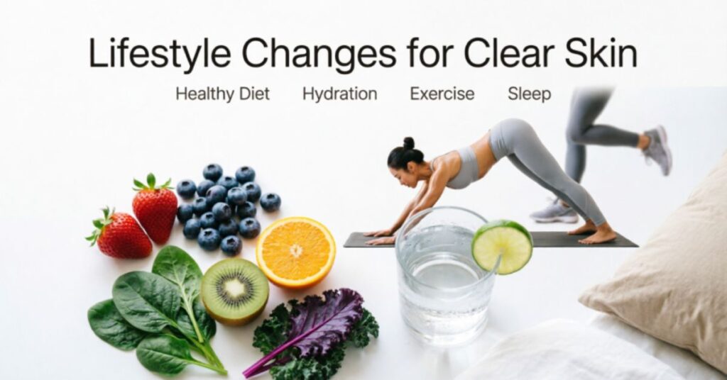 acne on cheeks meaning lifestyle changes healthy diet water exercise sleep for clear skin