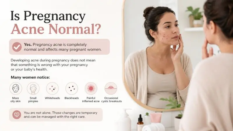 Pregnant woman with mild facial acne looking in a bathroom mirror, illustrating that pregnancy acne is a common and normal skin condition during pregnancy.